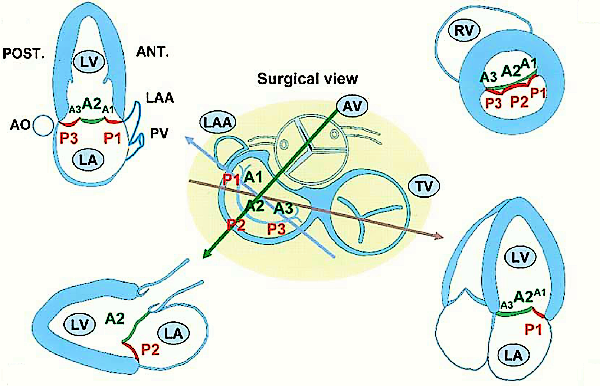 Figure-1-Four-imaging-planes-to-assess-the-precise-localization-of-prolapsed-or-flail