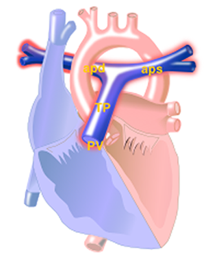 Pulmonary artery