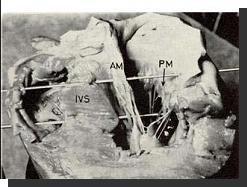 Histstructure_indentification