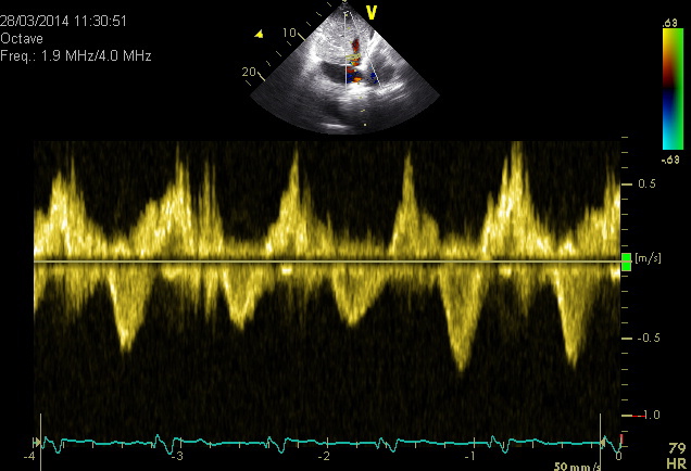 Hepatic 2